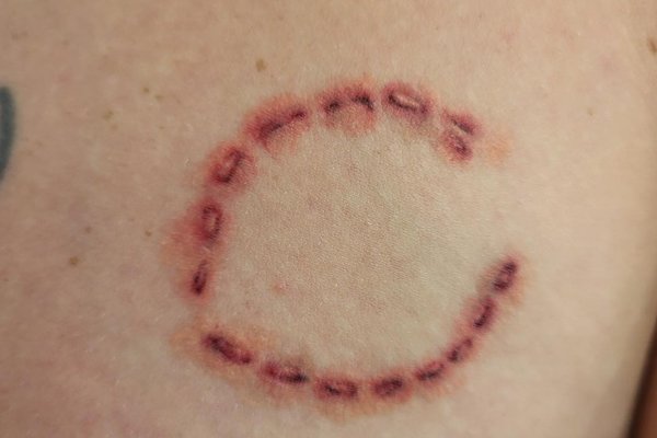 tatouage morsure