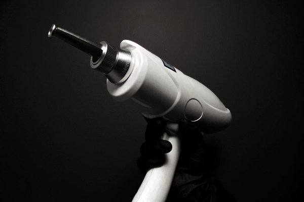 Le démaquillage permanent au laser à Montpellier