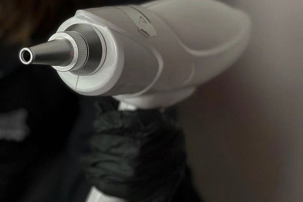 Le démaquillage permanent au laser à Montpellier