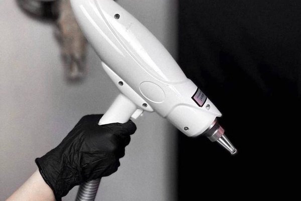 Le démaquillage permanent au laser à Montpellier