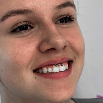 Piercing Smile